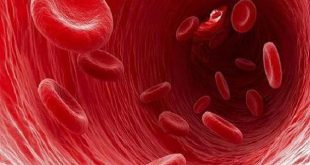 تشخیص کم خونی تنها در چند ثانیه!