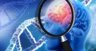آلودگی هوا ریسک بیماری آلزایمر را افزایش می‌دهد