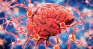 آیا آلزایمر در گذشته بیماری نادری بود؟
