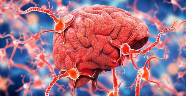آیا آلزایمر در گذشته بیماری نادری بود؟