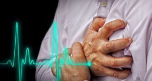 بومی‌سازی دستگاه شوک قلبی خودکار