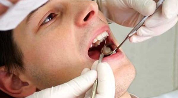 شیوع بیماری‌های لثه در میانسالی