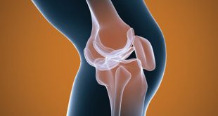 داروی رایج دیابت، مؤثر در تسکین درد آرتروز زانو