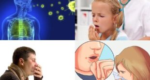 موارد ابتلا به سل در جهان به بالاترین حد خود رسیده است