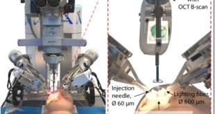 روبات و هوش مصنوعی جراح چشم شدند